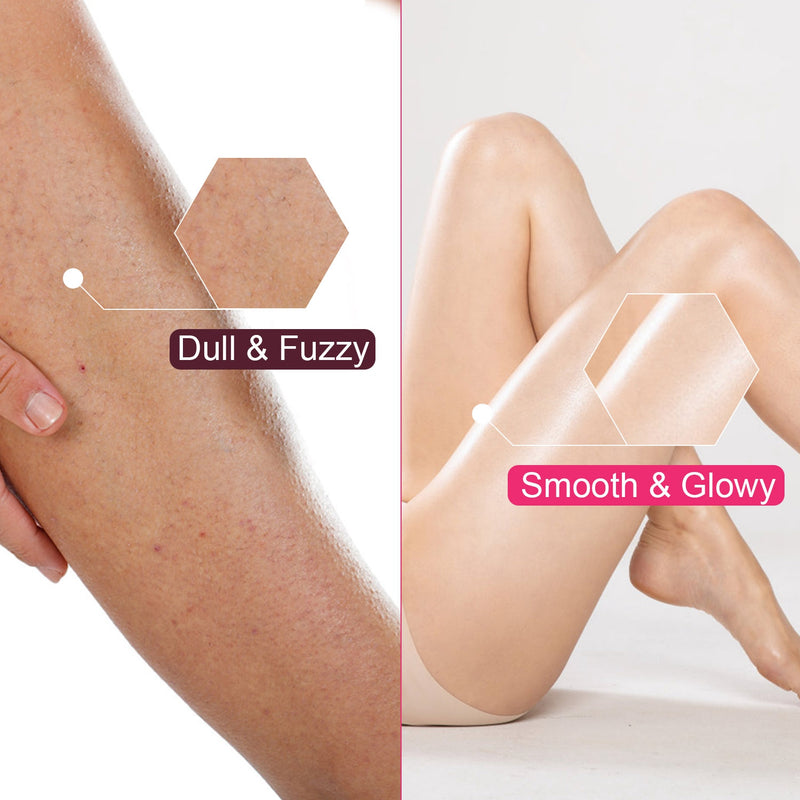 4-in-1 Electric Epilator for Women – USB Rechargeable, Waterproof, and Painless Shaver